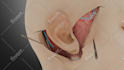 create 3d medical explainer video, 3d medical animation