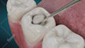 design high quality dental surgical 3d animations