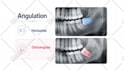 create a professional medical animated video