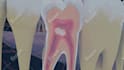 medical animation anatomy surgery biomedical animation medical oral implants vid