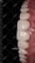 do a professional video editing on your dental cases