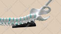 do 3d medical animation for a product or procedure