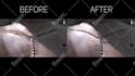 do vfx cleanup, object removal, replacement and keying