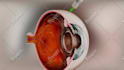 make 3d medical animation