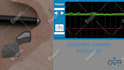 create esthetic medical and plastic surgery animations