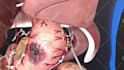 create 3d medical animation with high quality rendering