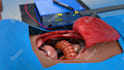 create 3d medical animation for you