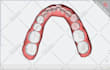 do dental clear aligner treatment planning on onyxceph