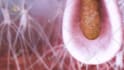 medical animation anatomy surgery biomedical animation medical oral implants vid