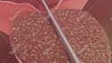 create professional 3d medical animation