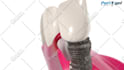 create 3d medical animation with high quality rendering