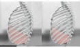 do 3d medical animation for a product or procedure