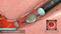 create 2d or 3d medical animations for you