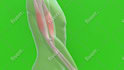 do 3d medical animation for a product or procedure