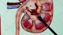create 3d medical animation and illustration