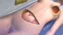 create 2d or 3d medical animations for you