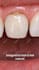 design high converting meta ads for clinics, medspas and dentists