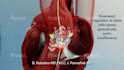 create high end 3d medical animation
