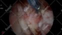 create 3d medical animation for you