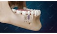 create 3d medical explainer video, 3d medical animation