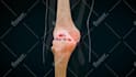 make 3d medical animation video