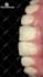 do a professional video editing on your dental cases