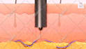 make 3d medical animation