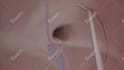 create 3d medical animation with high quality rendering
