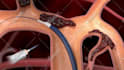 do high quality 3d medical animation and product modeling