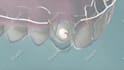 do dental animation in 3d