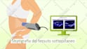 create animated explainer video for your brand and service