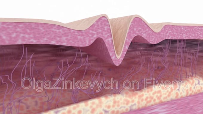 create 3d medical animation