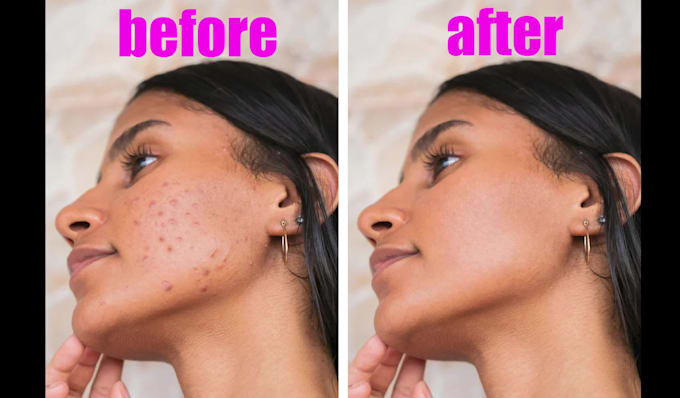 remove pimples and small tattoos from photos