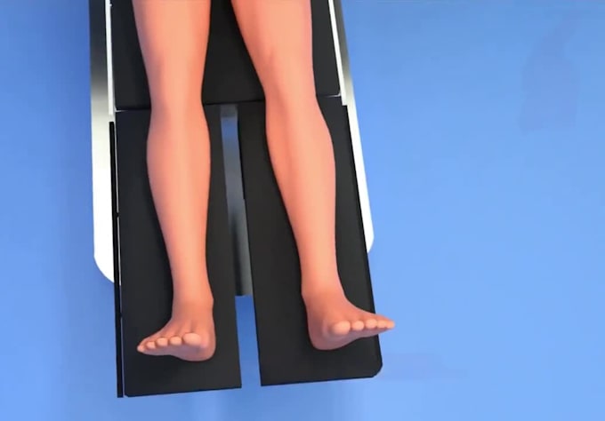 Do explainer 3d medical animation 3d orthopedic surgery animation 3d ...