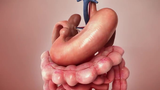 do 3d medical animation video surgery animation surgical model 3d dental video