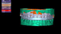 design occlusal splints, night guards and retainers