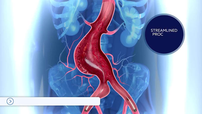 create realistic 3d medical animation, explainer video 3d software