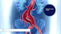 create realistic 3d medical animation, explainer video 3d software