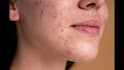 create natural beauty skin retouching in photoshop