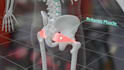 do 3d medical animation for a product or procedure