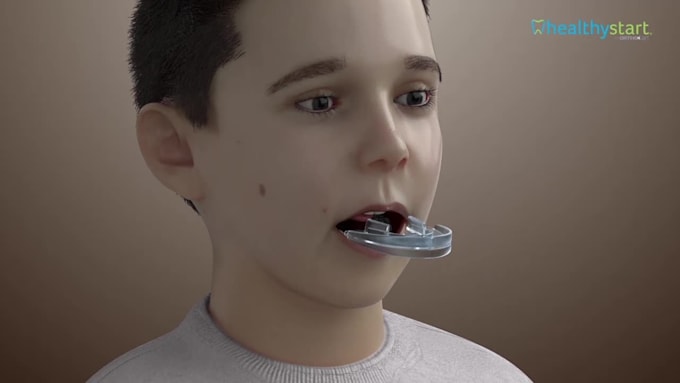 do 3d medical product and device animation