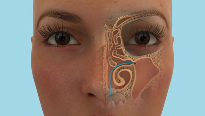 create high quality 3d medical animation, surgery animation