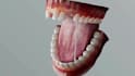 create 3d dental implant animation orthodontic explainer and dental device video