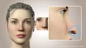design 3d plastic surgery and cosmetic procedure animations