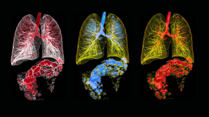 Create a medical 3d animation based on your ct or mri dicom by ...