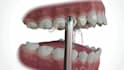 do dental animation in 3d