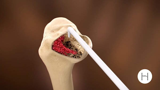 create professional 3d medical animation