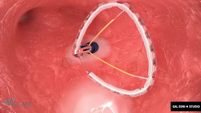 create high end 3d and ai medical animation videos and films