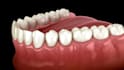 create a premium dental video, 3d medical animation, surgery animation