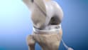 create precise orthopedic 3d medical animations
